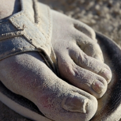 Extremely dusty foot